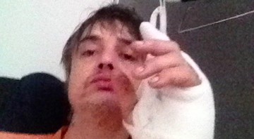 Pete Doherty publicou uma imagem sobre sua hospitalização (Foto: Twitter / Reprodução)