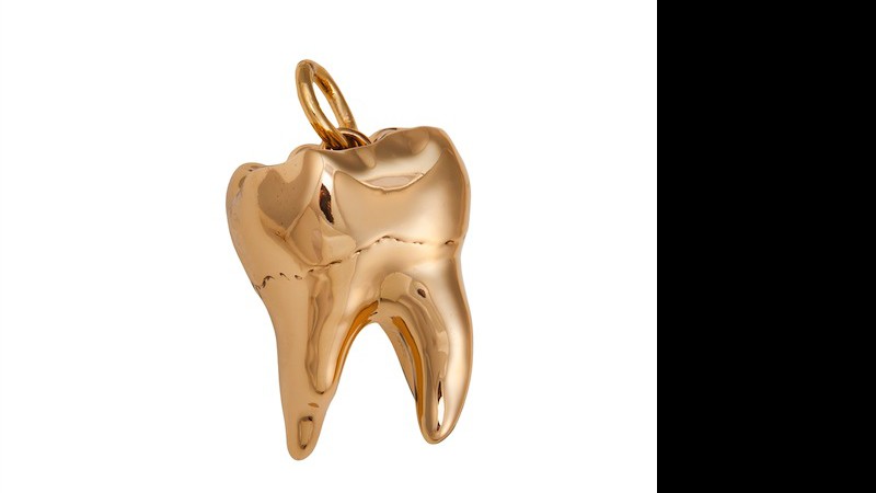 Ke$ha moldou os dentes em cima de dentes que ganhou de fãs