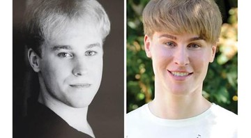 Tobias Strebel antes e depois dos procedimentos para se parecer com Justin Bieber - Reprodução / Instagram